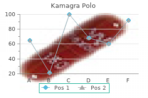 order 100 mg kamagra polo amex