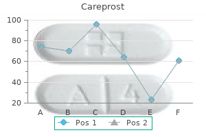 quality 3 ml careprost