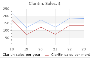 claritin 10 mg purchase fast delivery