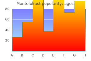 cheap montelukast 4 mg buy on line