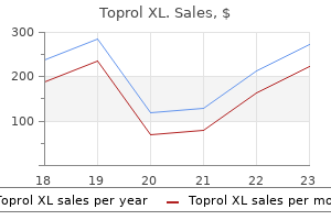 discount toprol xl 50 mg buy online