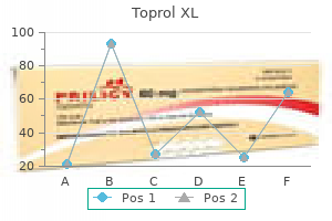 purchase toprol xl 25 mg on line