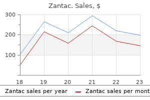 zantac 150 mg otc