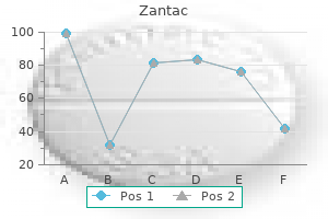 zantac 300 mg buy visa