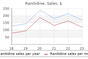 order 300 mg ranitidine visa