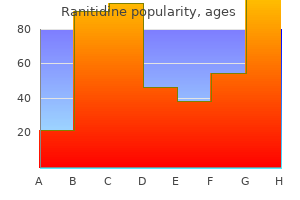 purchase ranitidine 150 mg on line