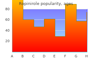 1 mg ropinirole amex