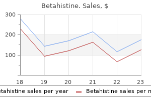 purchase betahistine 16mg visa