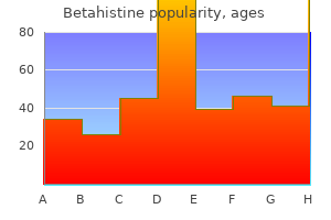 purchase betahistine 16 mg mastercard