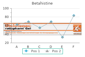 betahistine 16mg buy with visa