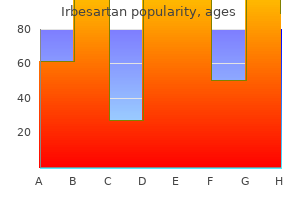 cheap irbesartan 150 mg overnight delivery