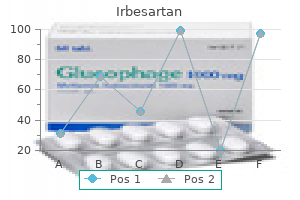 150 mg irbesartan buy visa