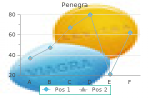 generic penegra 50 mg line