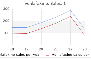 order venlafaxine 75 mg with amex