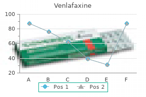 order 75 mg venlafaxine amex