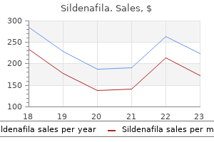 order 25 mg sildenafila fast delivery