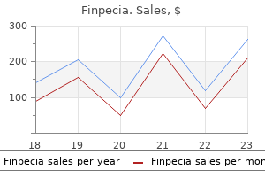 order 1 mg finpecia otc