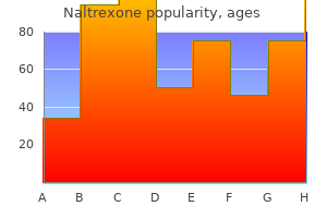 buy cheap naltrexone 50 mg on line