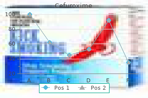 cefuroxime 500 mg with mastercard