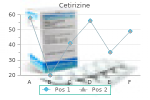 10 mg cetirizine purchase with visa