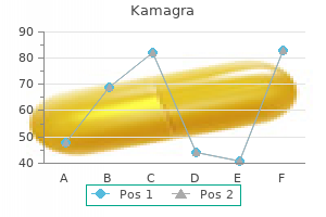 best buy kamagra